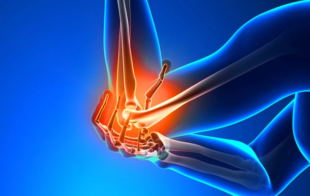 Rehabilitación · ¿Conoces la enfermedad del Codo de tenista?