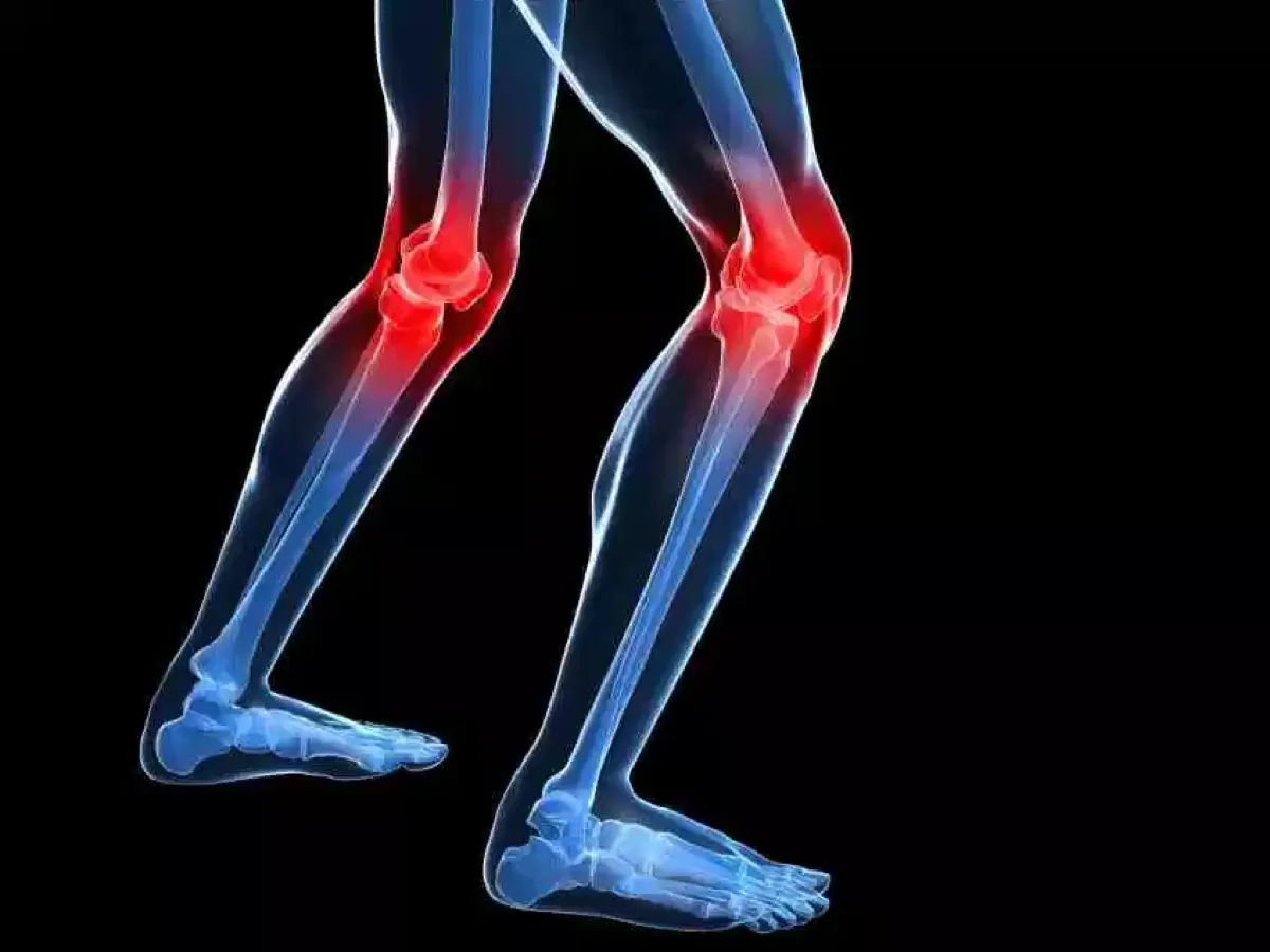 Terapia para dolor de rodilla CDMX