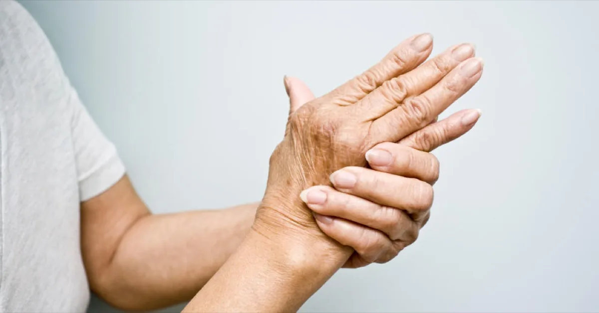 Rehabilitación · Artritis Reumatoide