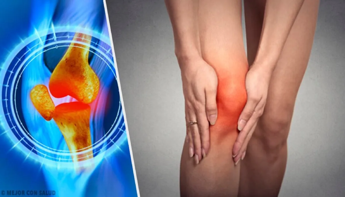 Rehabilitación · Artrosis de Rodilla